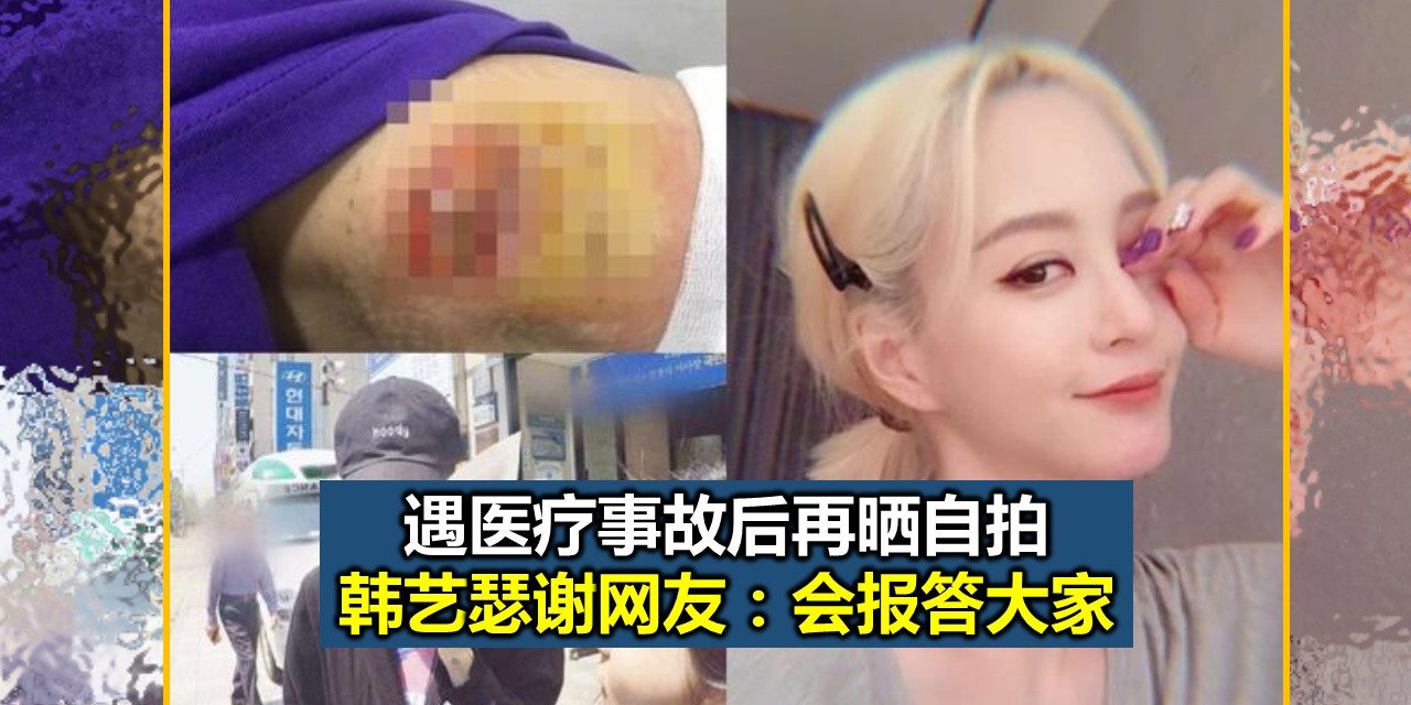 韩艺瑟遇医疗事故后再晒自拍 谢网友：会报答大家