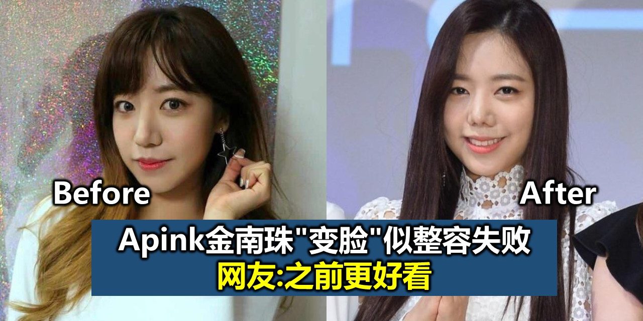 Apink金南珠”变脸”似整容失败 网友:之前更好看