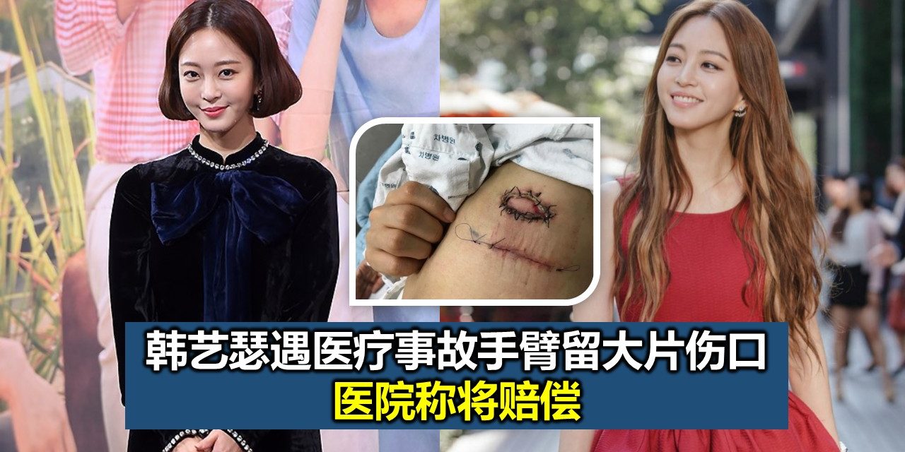 韩艺瑟遇医疗事故手臂留大片伤口 医院称将赔偿