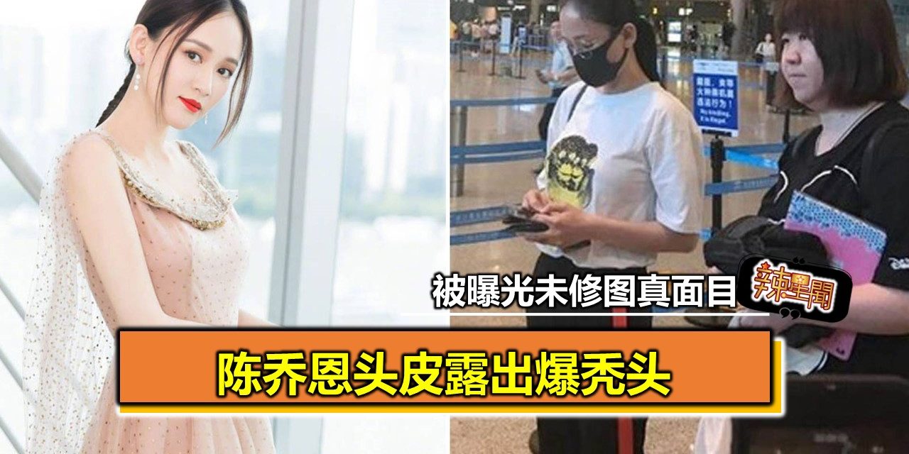 被曝光未修图真面目 陈乔恩头皮露出爆秃头