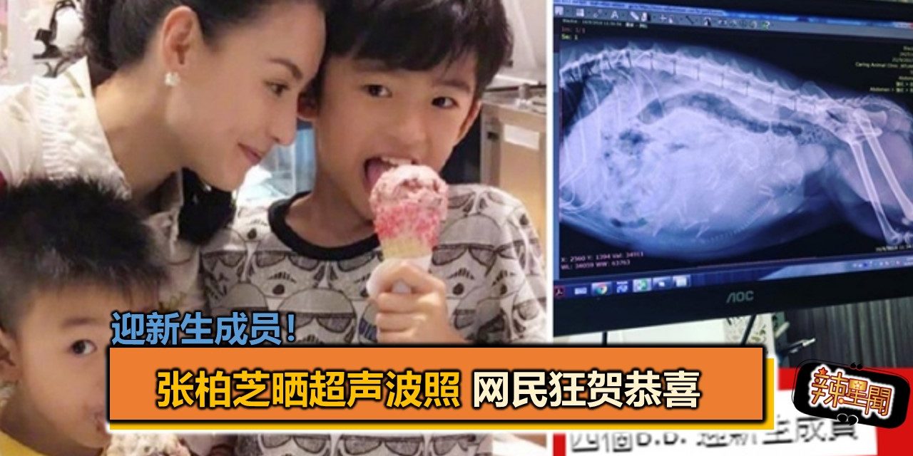 迎新生成员！张柏芝晒超声波照 网民狂贺恭喜