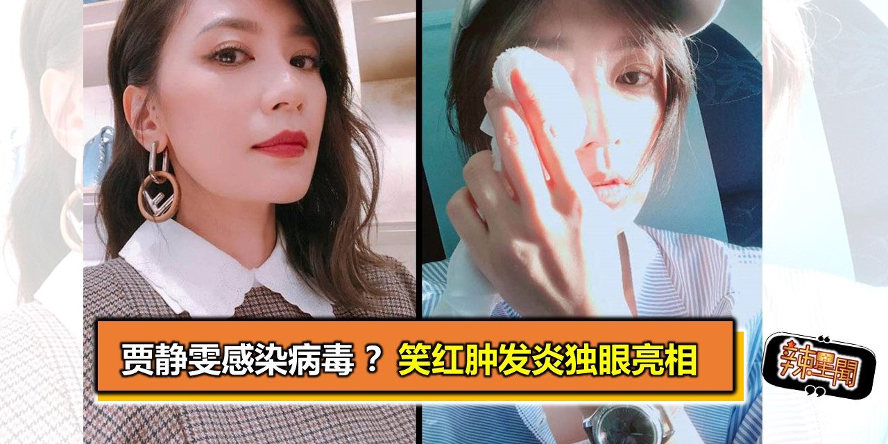 贾静雯感染病毒 红肿发炎独眼亮相