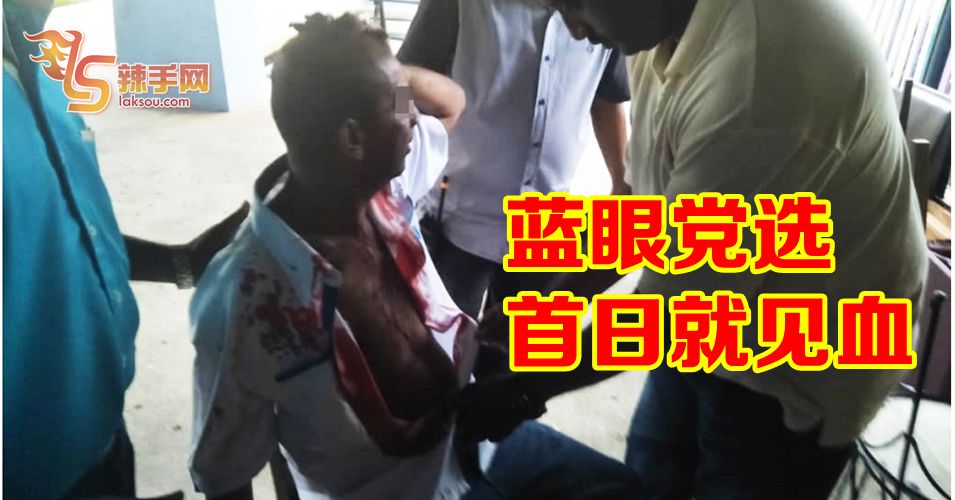 公正党双溪大年党选发生见血事件