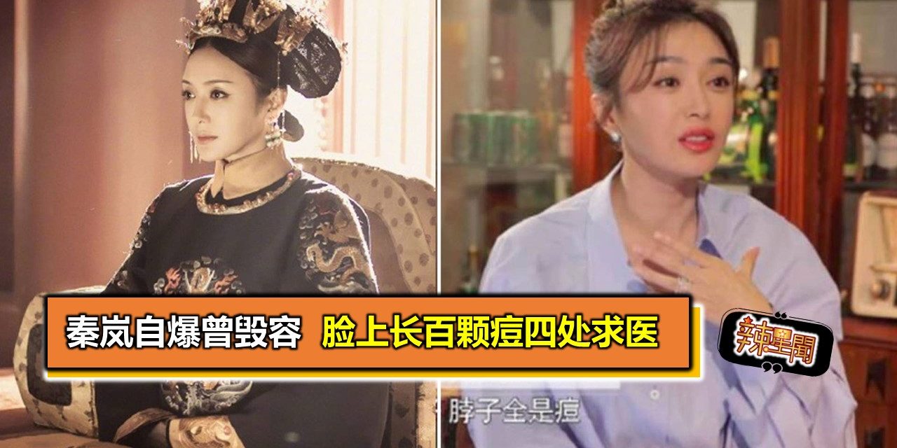 秦岚自爆曾毁容 脸上长百颗痘四处求医