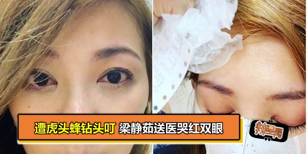 遭虎头蜂钻头叮 梁静茹送医哭红双眼