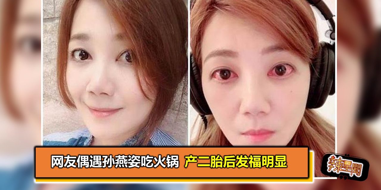 梁静茹晒自拍吓坏粉丝 双眼通红布满血丝