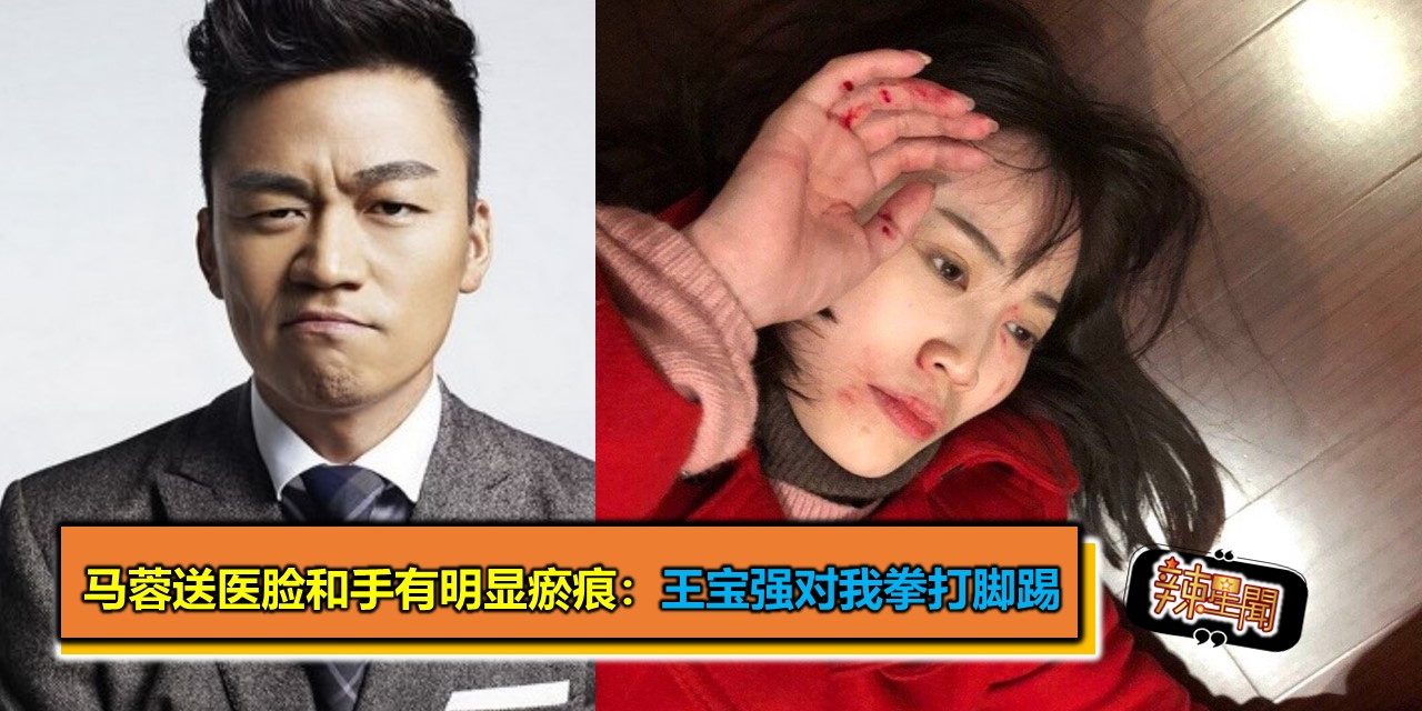 马蓉送医脸和手有明显瘀痕：王宝强对我拳打脚踢