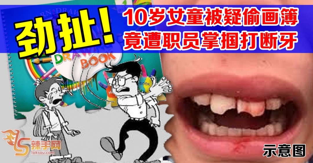 疑偷彩色画册  女童遭打断牙