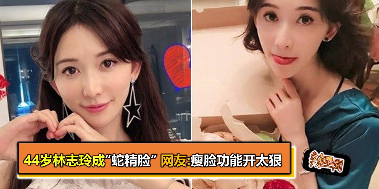 44岁林志玲成”蛇精脸”　网友:瘦脸功能开太狠