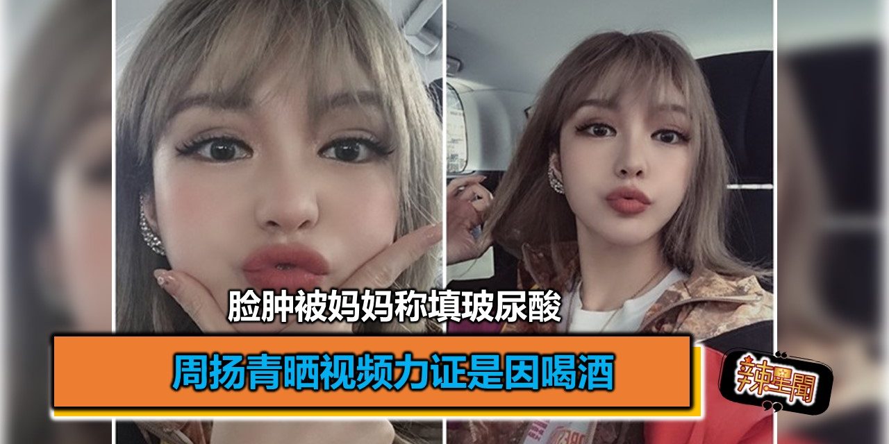 脸肿被妈妈称填玻尿酸 周扬青晒视频力证是因喝酒