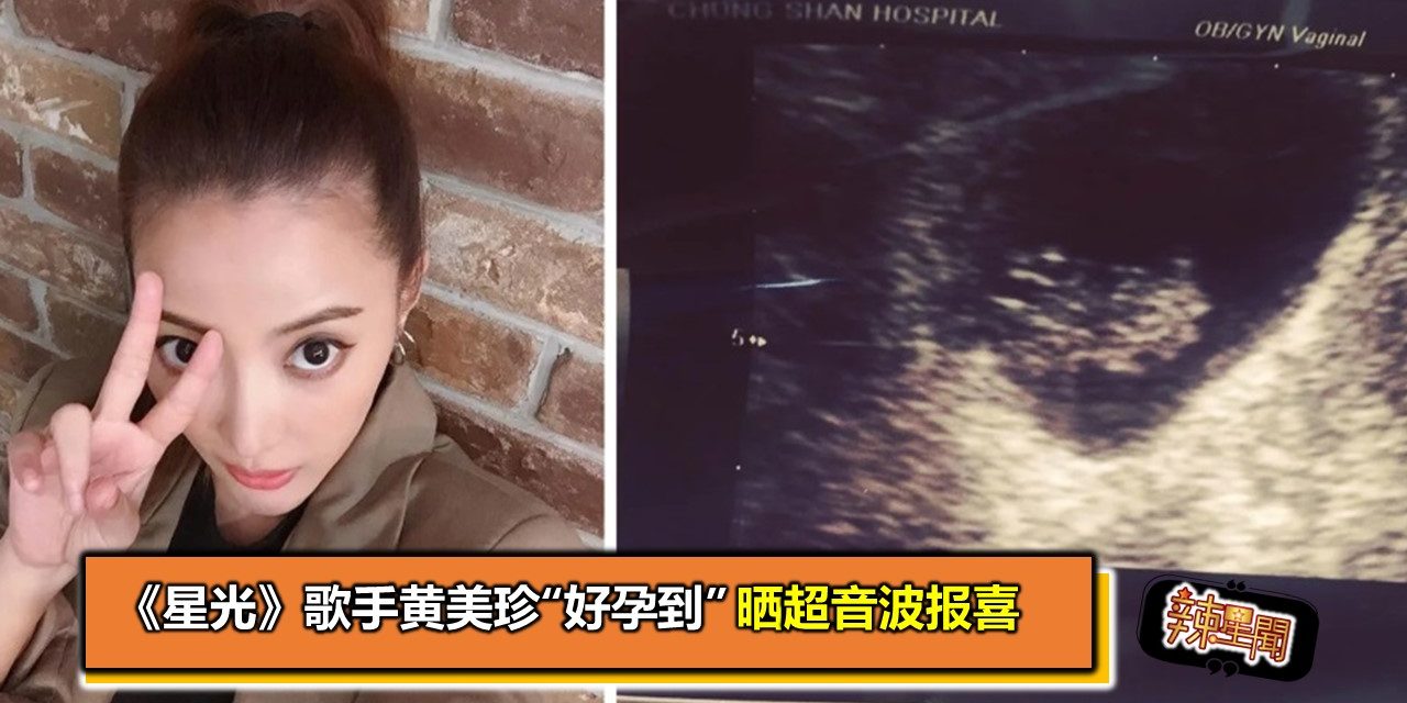 《星光》歌手黄美珍“好孕到”　晒超音波报喜