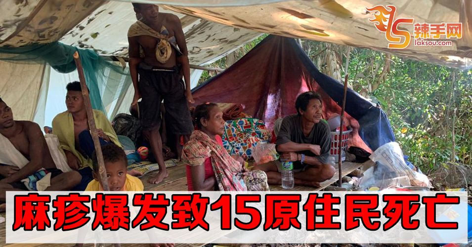 15原住民死亡  确诊是麻疹爆发