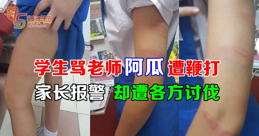 学生骂老师阿瓜遭鞭打  家长报警 却遭各方讨伐