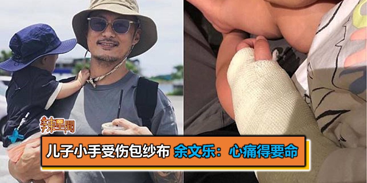 儿子小手受伤包纱布 余文乐：心痛得要命