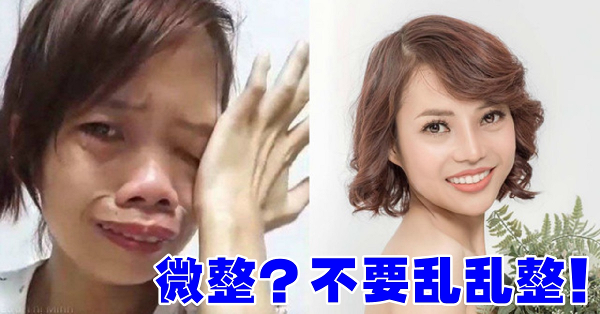 微整？不要乱乱整！