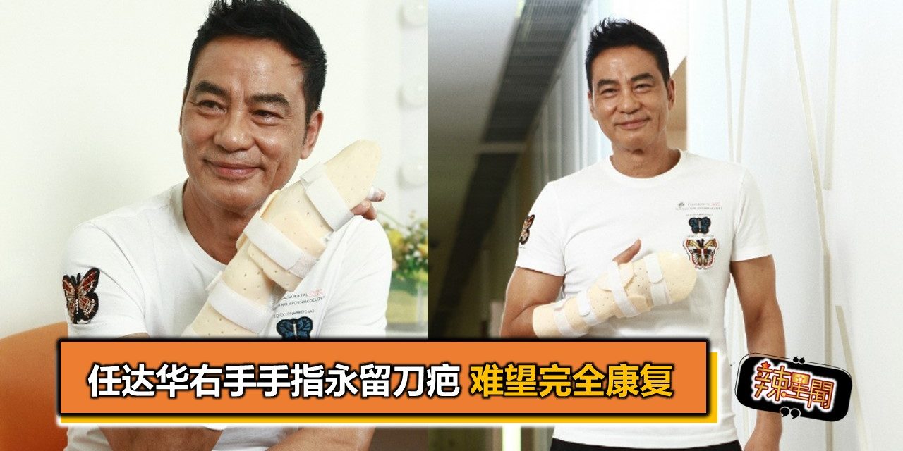 任达华右手手指永留刀疤 难望完全康复