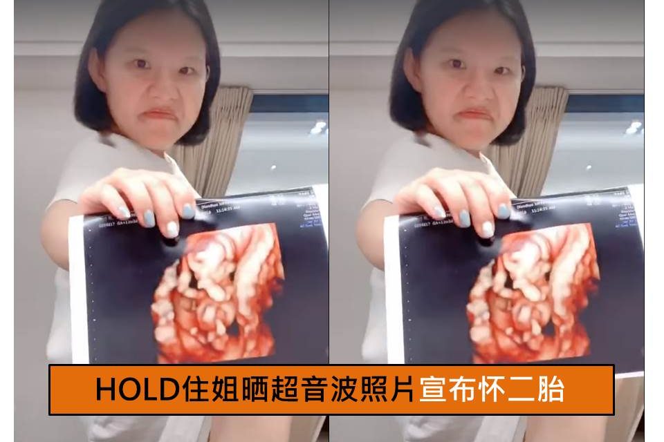 HOLD住姐晒超音波照片宣布怀二胎