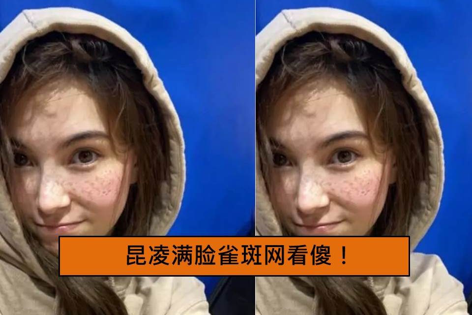 昆凌满脸雀斑网看傻！