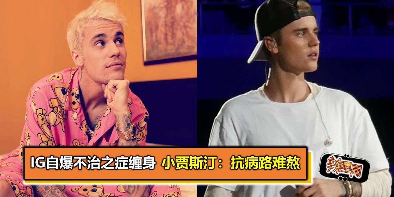 IG自爆不治之症缠身 小贾斯汀：抗病路难熬