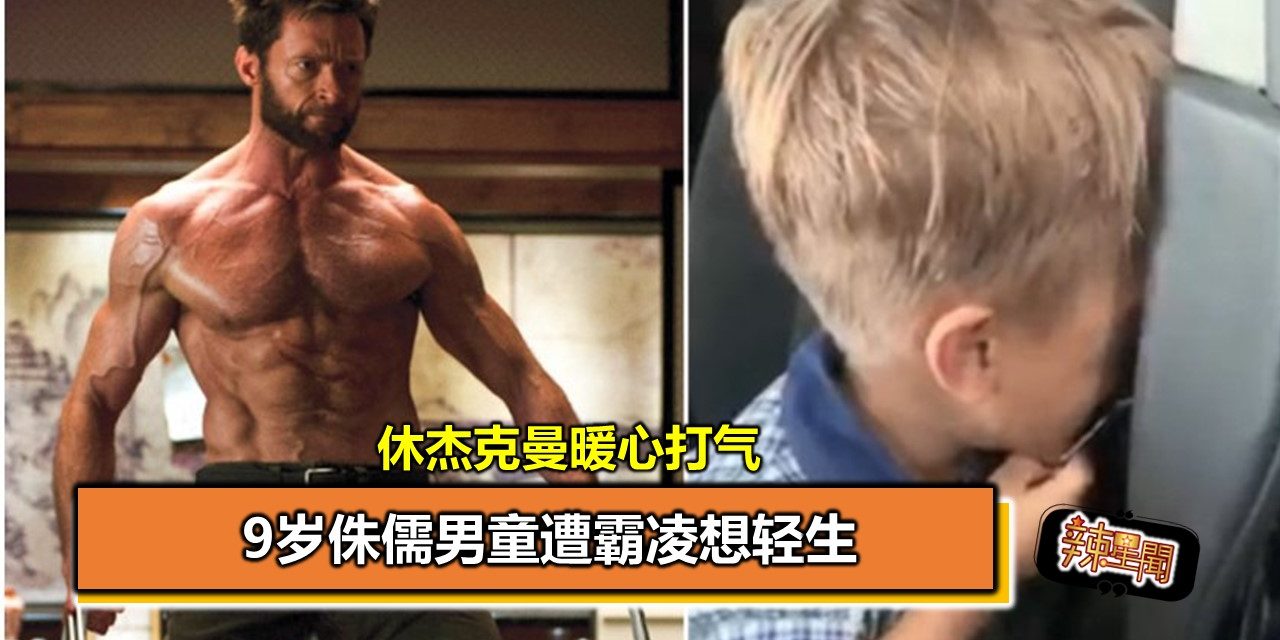 9岁侏儒男童遭霸凌想轻生 休杰克曼暖心打气