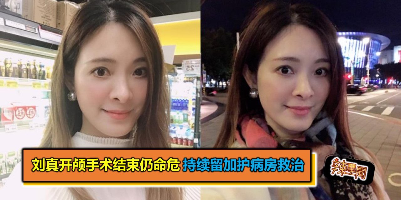 刘真开颅手术结束仍命危　持续留加护病房救治