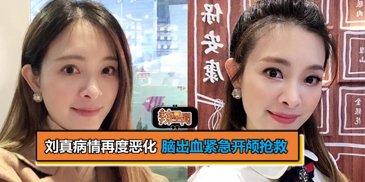 刘真病情再度恶化 脑出血紧急开颅抢救