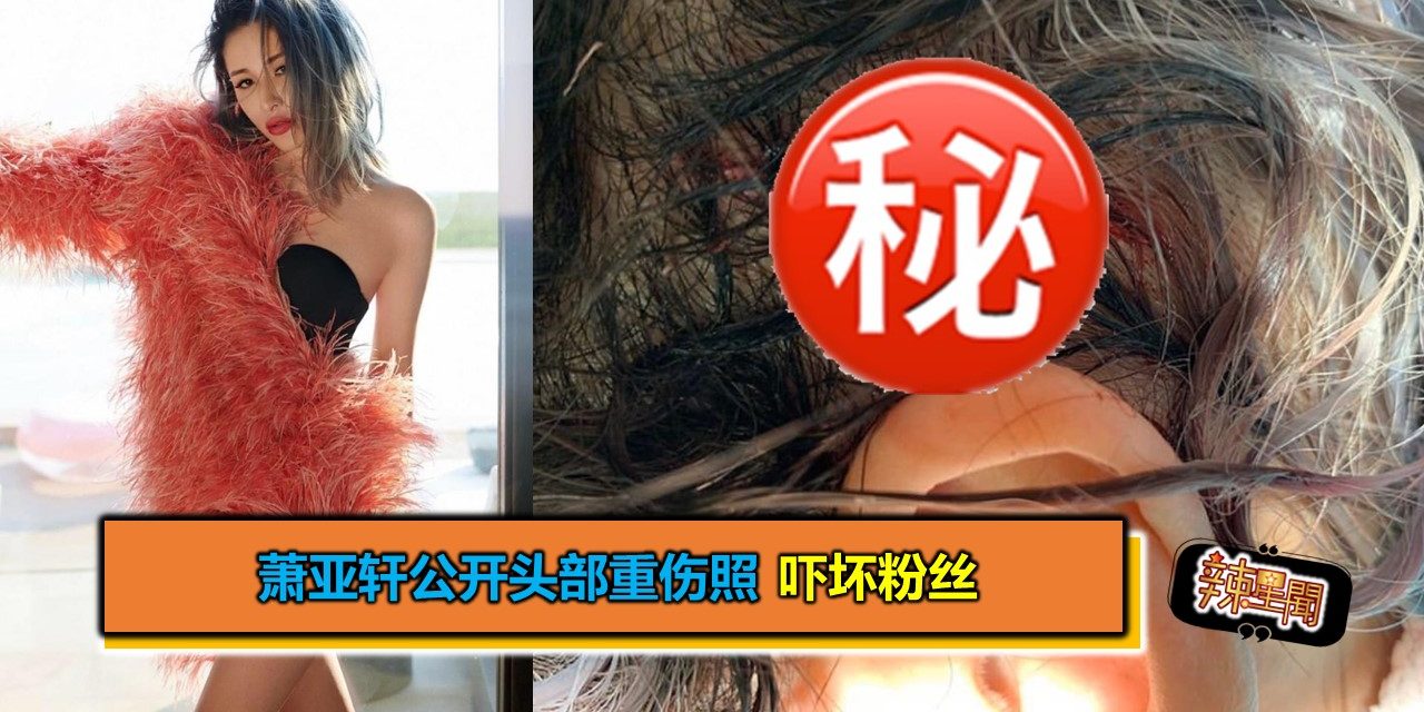 萧亚轩公开头部重伤照 吓坏粉丝