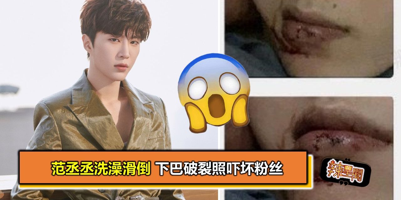 范丞丞洗澡滑倒 下巴破裂照吓坏粉丝