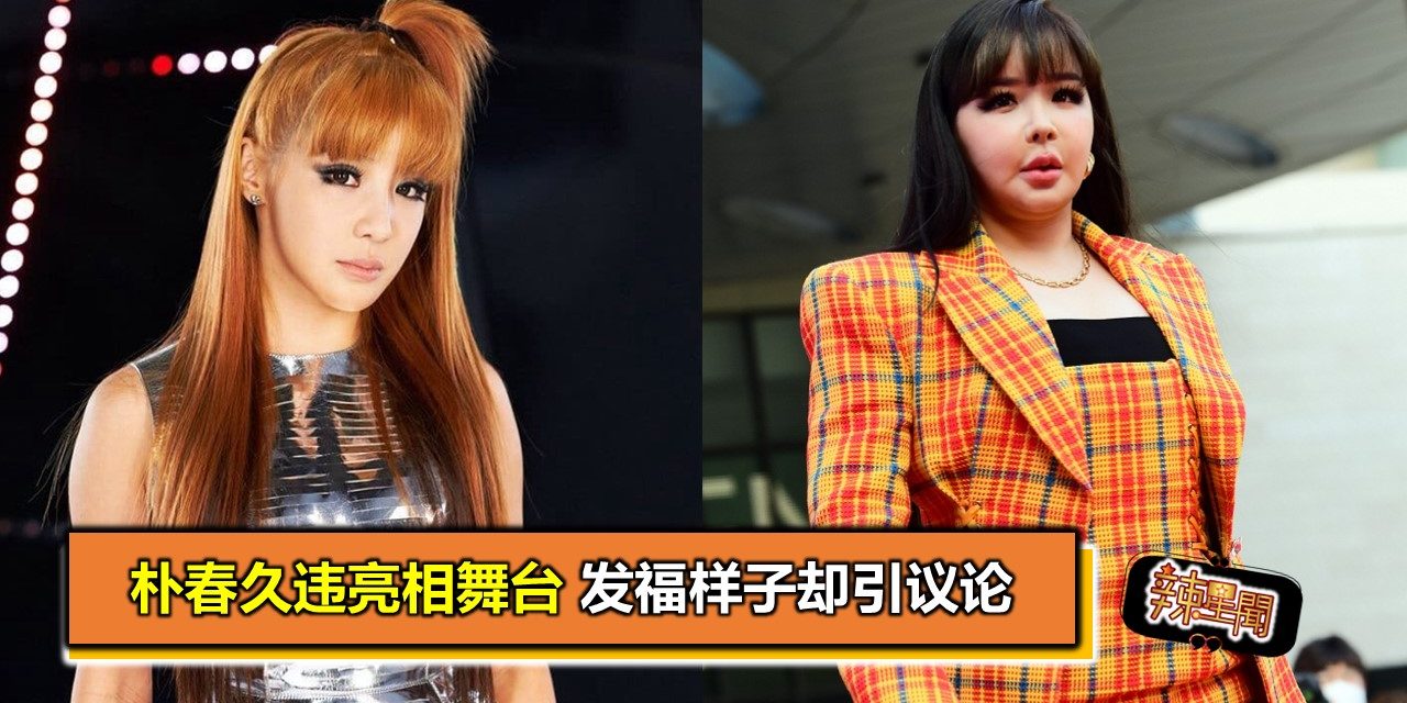 朴春久违亮相舞台 发福样子却引议论