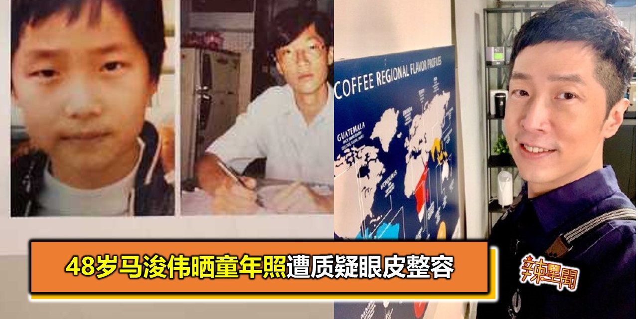48岁马浚伟晒童年照遭质疑眼皮整容