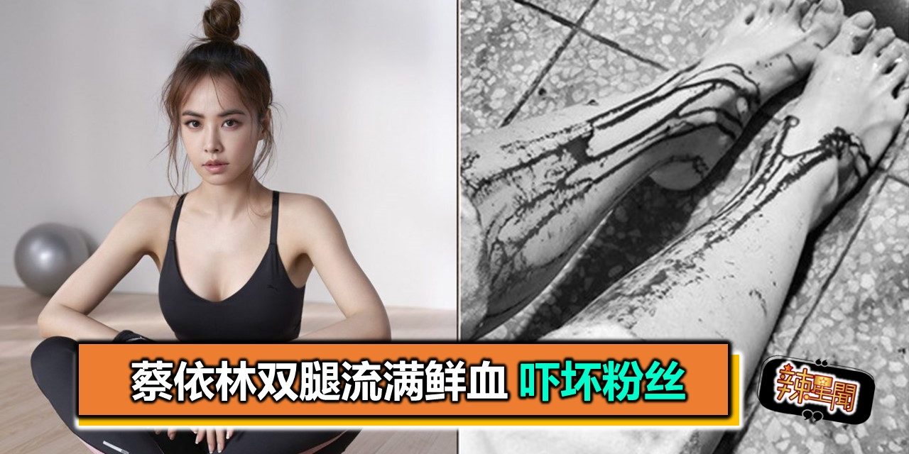 蔡依林双腿流满鲜血 吓坏粉丝