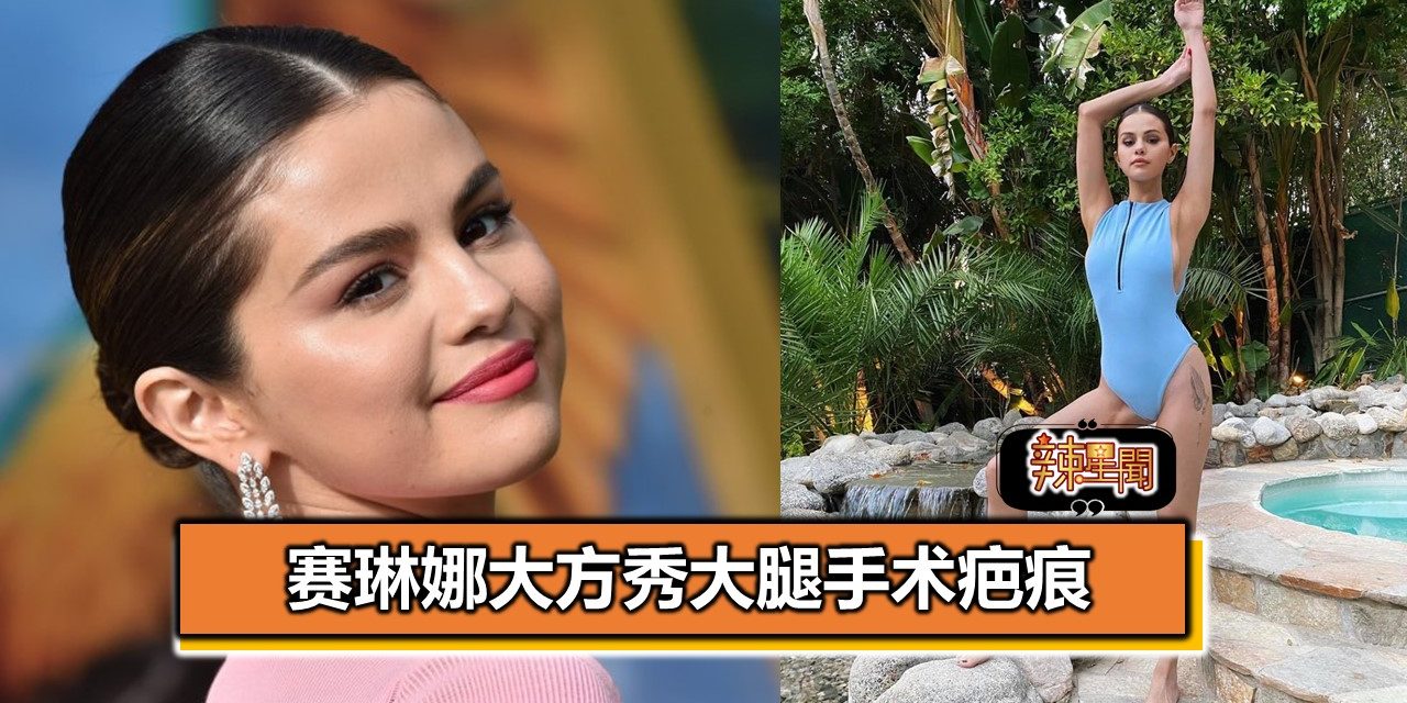 赛琳娜大方秀大腿手术疤痕　