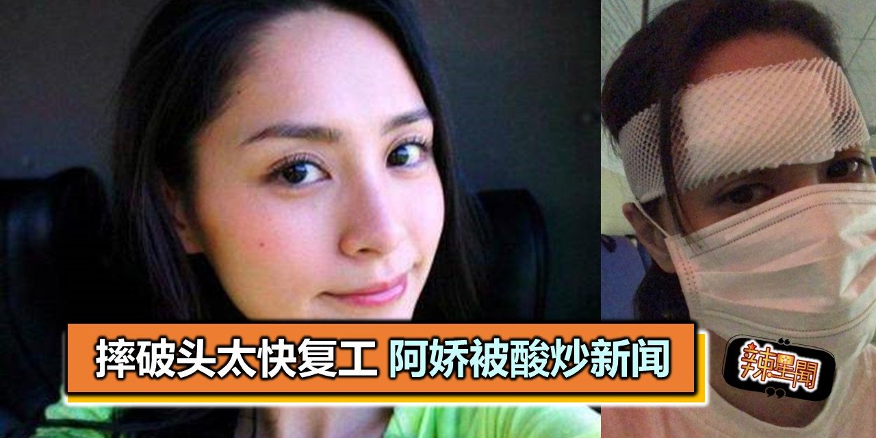 摔破头太快复工 阿娇被酸炒新闻