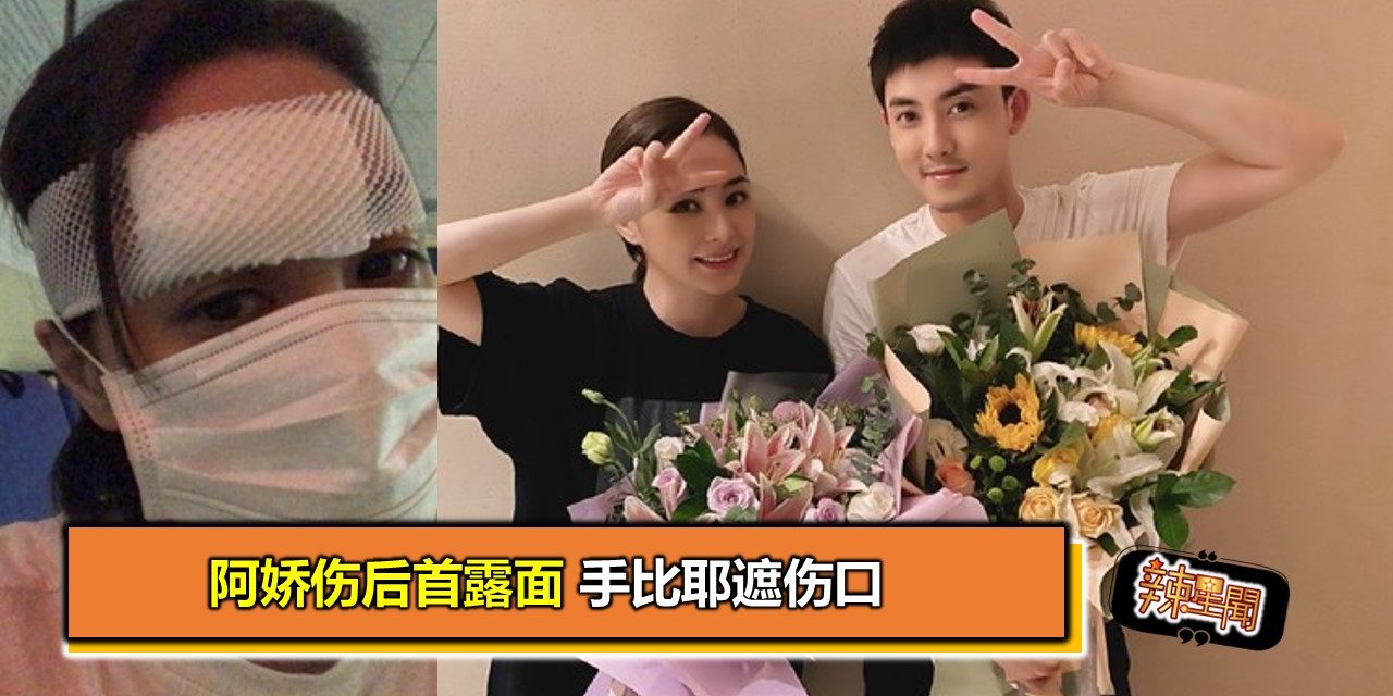 阿娇伤后首露面 手比耶遮伤口