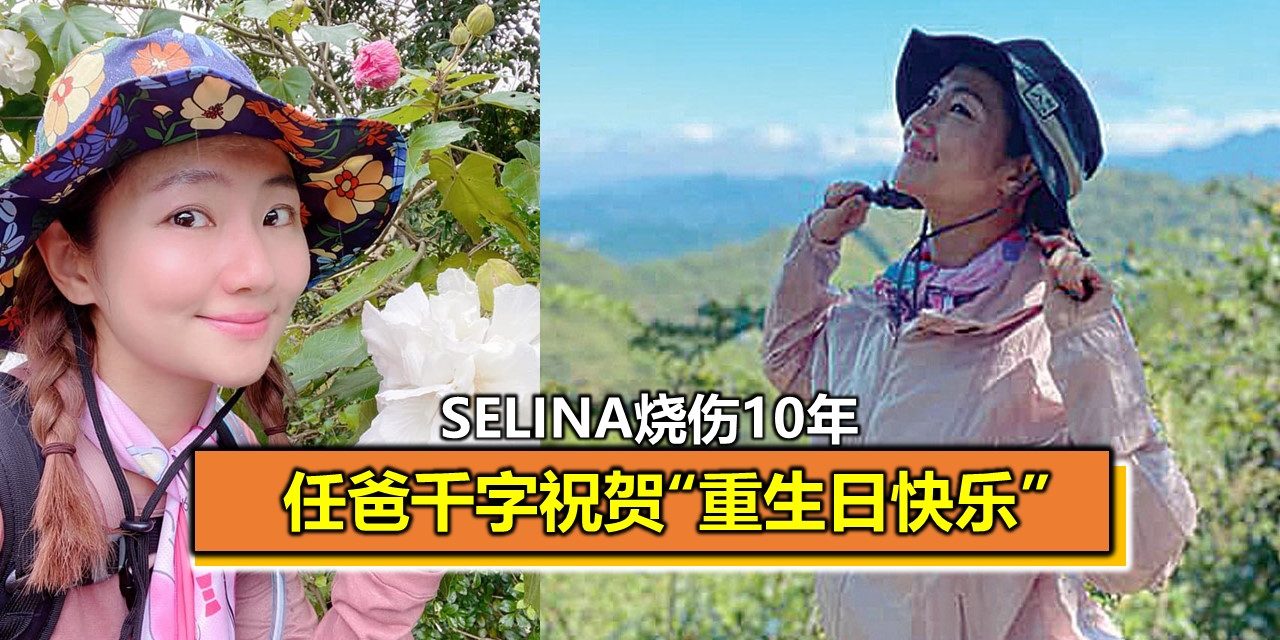 Selina烧伤10年 任爸千字祝贺“重生日快乐”