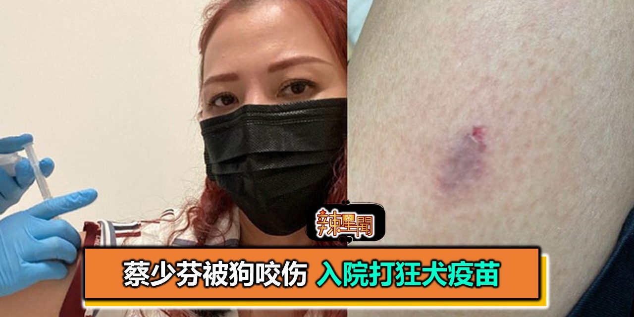 蔡少芬被狗咬伤 入院打狂犬疫苗