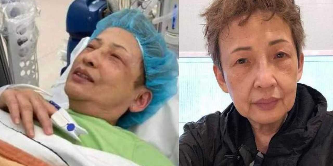 76岁冯素波生腺瘤 决定割除免恶化