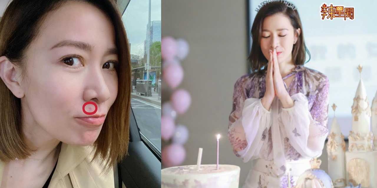 佘诗曼晒自拍 自嘲46岁还长痘