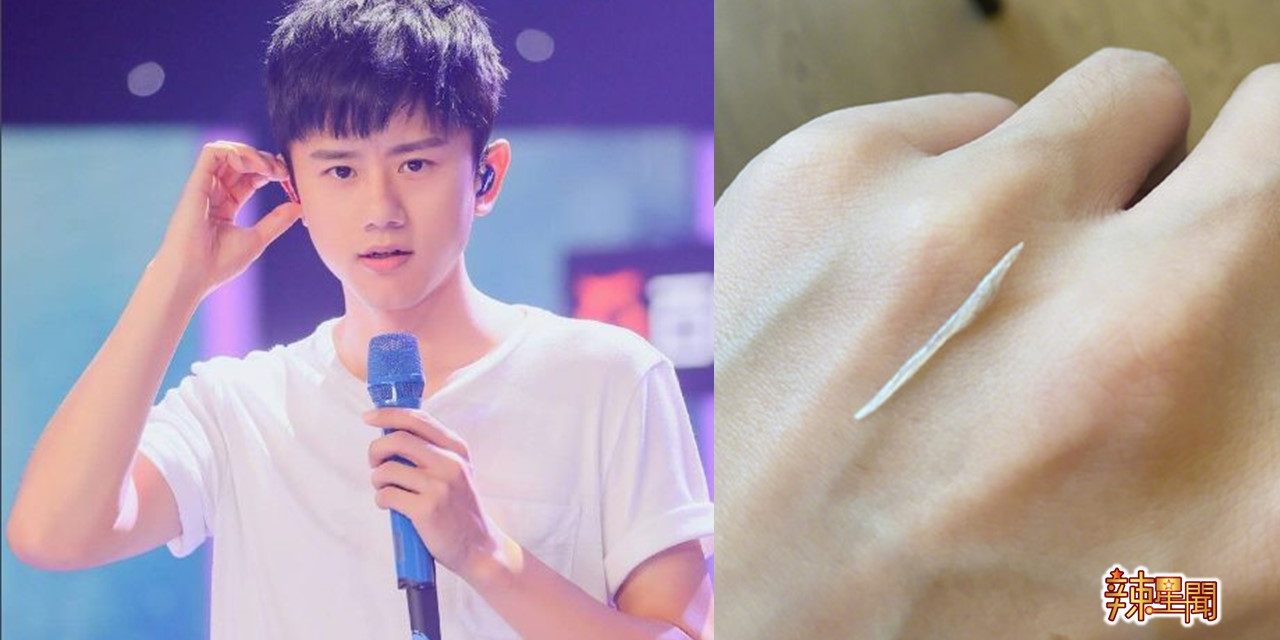 张杰被3厘米鱼刺卡食道 深夜急诊就医