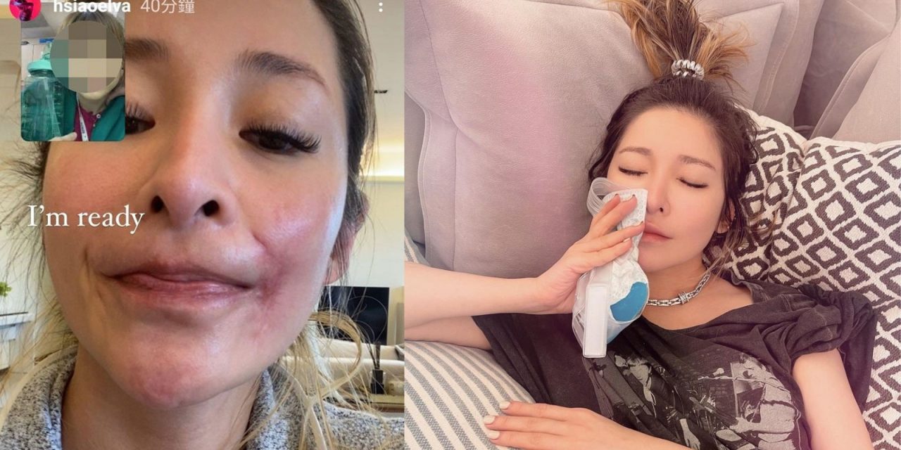 萧亚轩动手术“像被熨斗烫到” 与男友异地恋关系难定