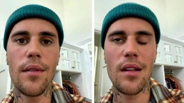 Justin Bieber右边脸瘫痪 巡演行程急喊卡