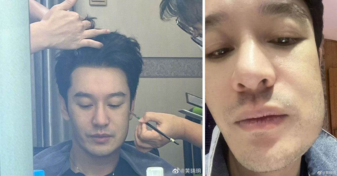 黄晓明拔智齿脸肿 网笑疯：整个人都方了