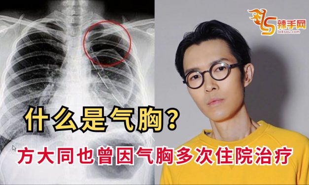“爆肺”不是夸张！了解气胸风险，及早预防
