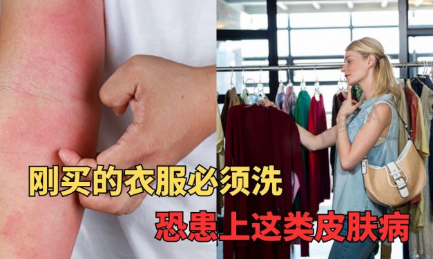 刚买的新衣服必须洗 否则恐患上严重皮肤病