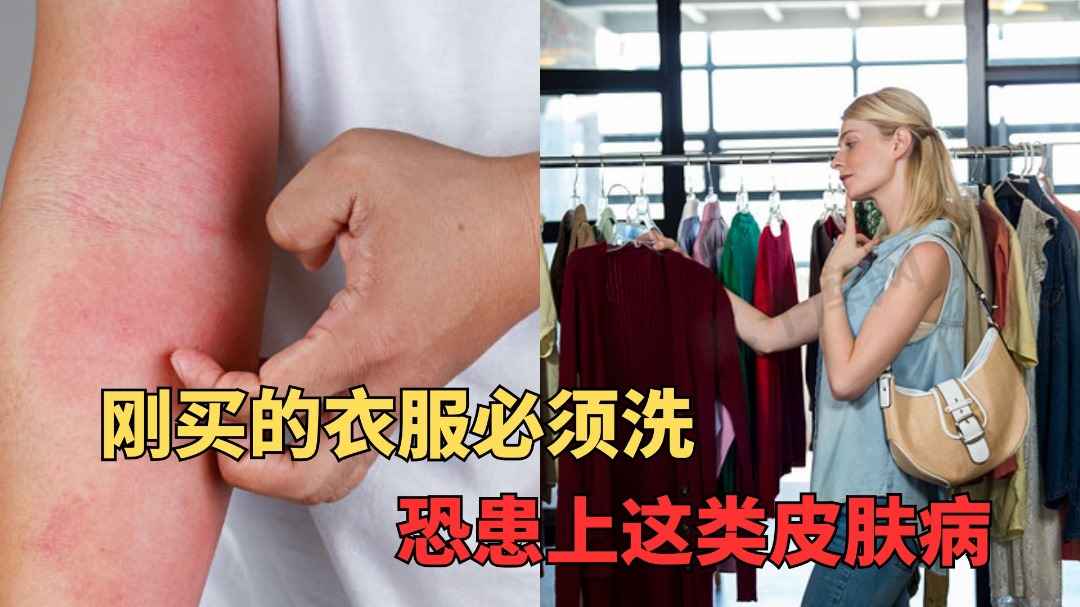刚买的新衣服必须洗 否则恐患上严重皮肤病