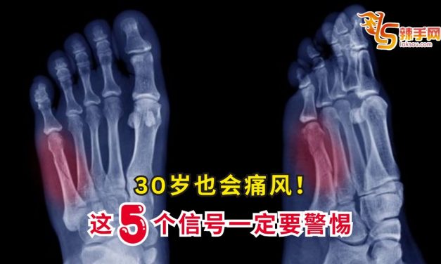 30岁也会痛风！这5个信号一定要警惕