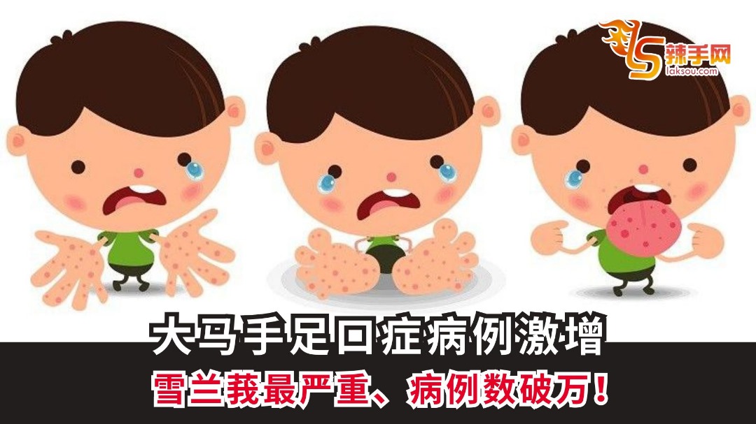 大马手足口症病例激增 雪兰莪最严重、病例数破万